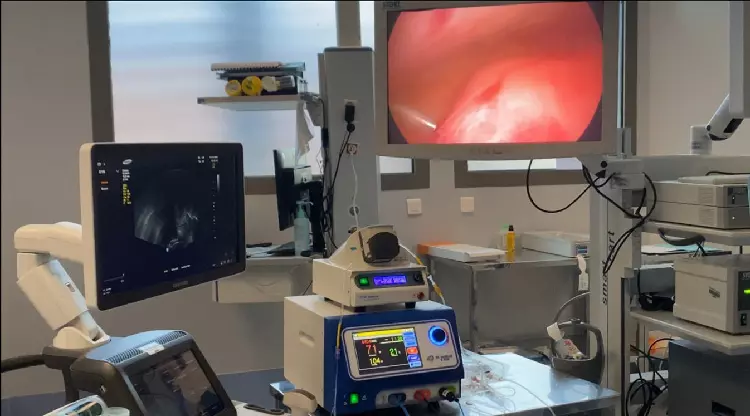 Santé à La Réunion : Le CHOR introduit la radiofréquence utérine pour le traitement des fibromes et de l’adénomyose, une première pour le territoire