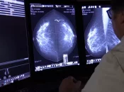 Cancer du sein : Le gouvernement de Polynésie va abaisser l’âge de dépistage gratuit à 45 ans pour toutes les femmes