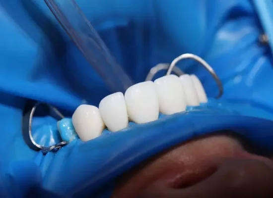 Martinique : Une première en implantologie dentaire après reconstruction osseuse au CHU de Martinique