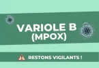 Un cas de variole du singe confirmé à La Réunion