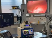 Santé à La Réunion : Le CHOR introduit la radiofréquence utérine pour le traitement des fibromes et de l’adénomyose, une première pour le territoire