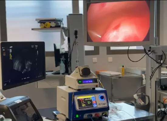 Santé à La Réunion : Le CHOR introduit la radiofréquence utérine pour le traitement des fibromes et de l’adénomyose, une première pour le territoire